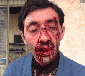of the special effects film trick wounds of the character Marcello from the film 'Dogman' directed by Matteo Garrone